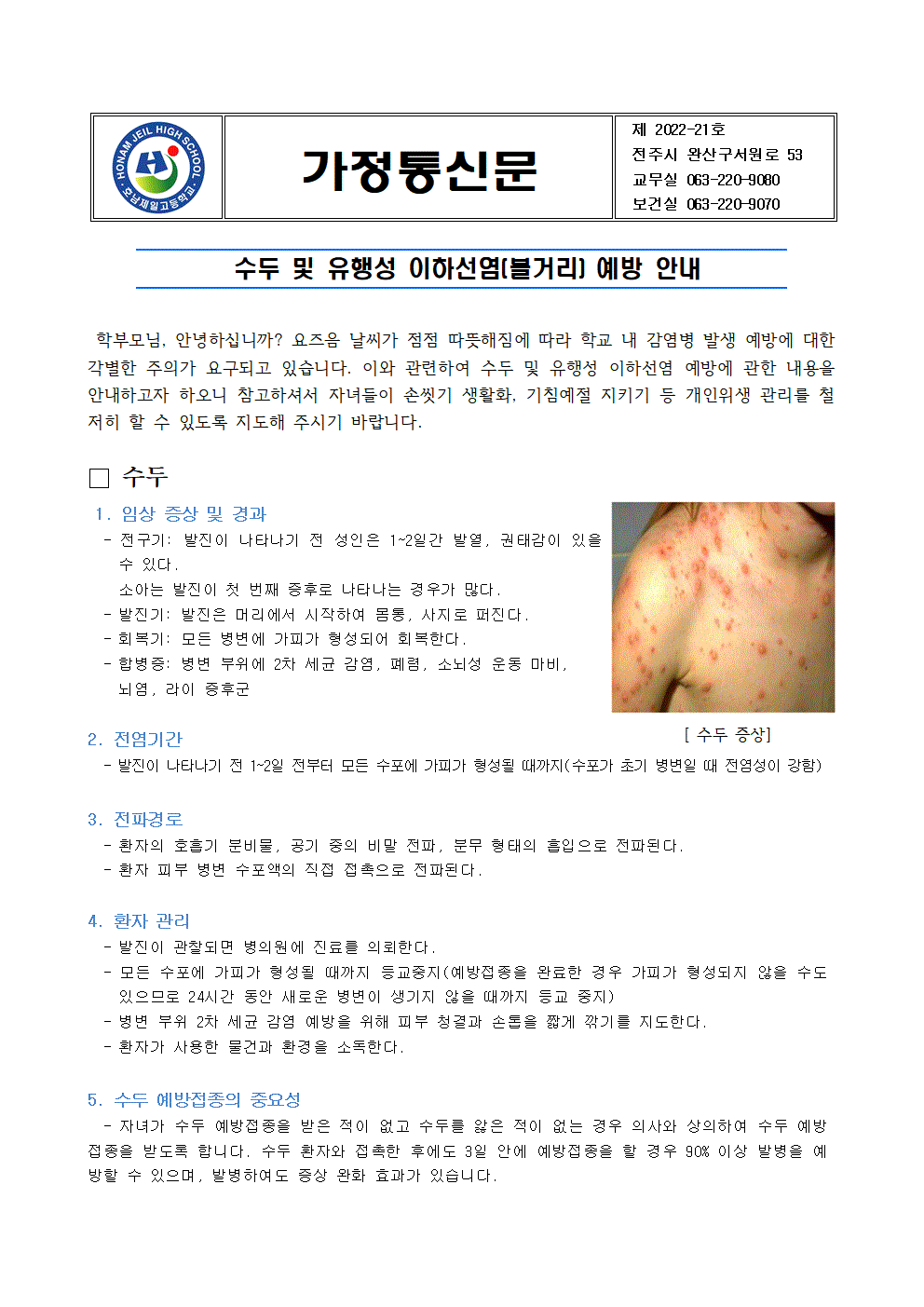 수두 및 유행성 이하선염 예방 안내001