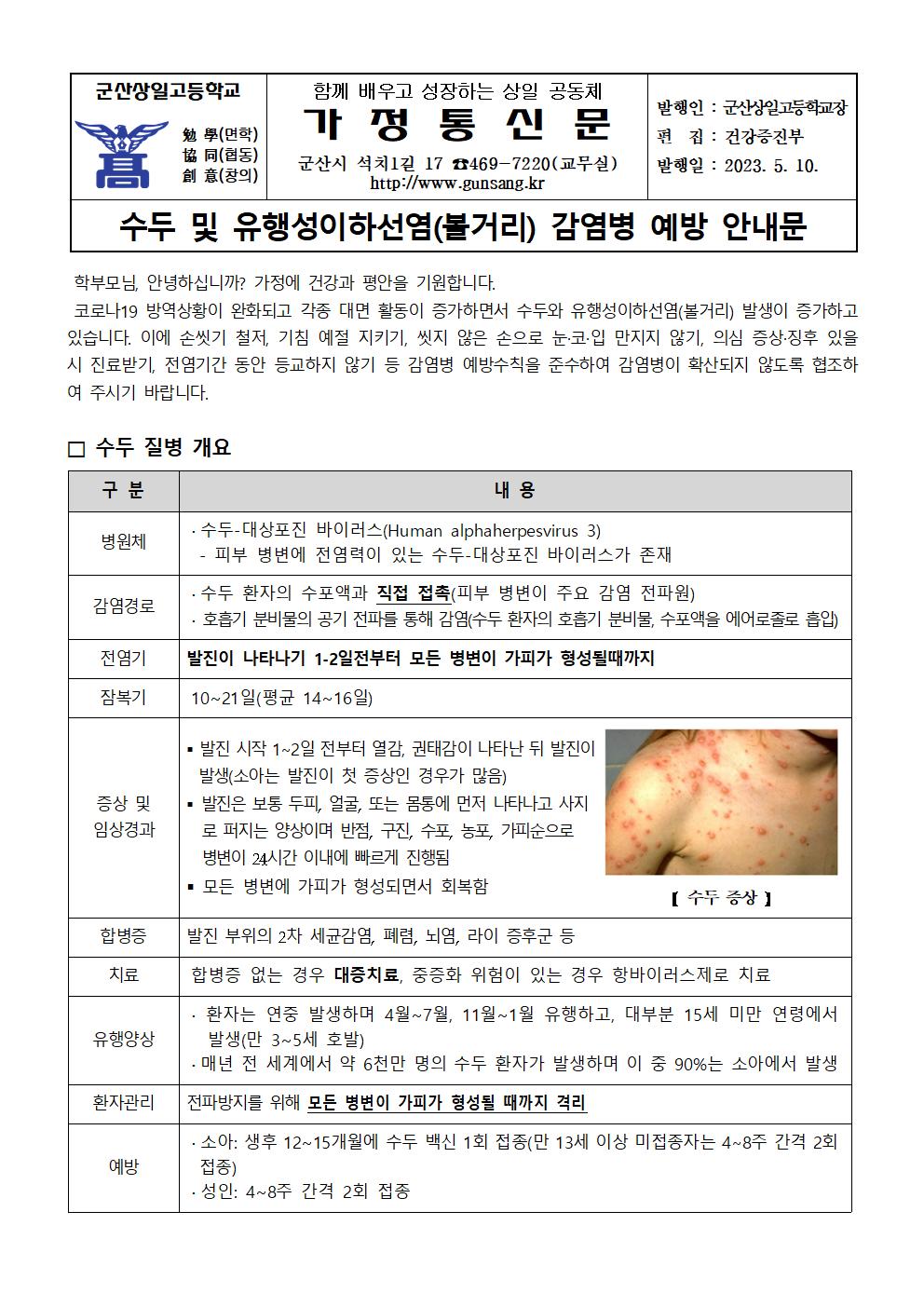 수두 및 유행성이하선염(볼거리) 감염병 예방 안내문001