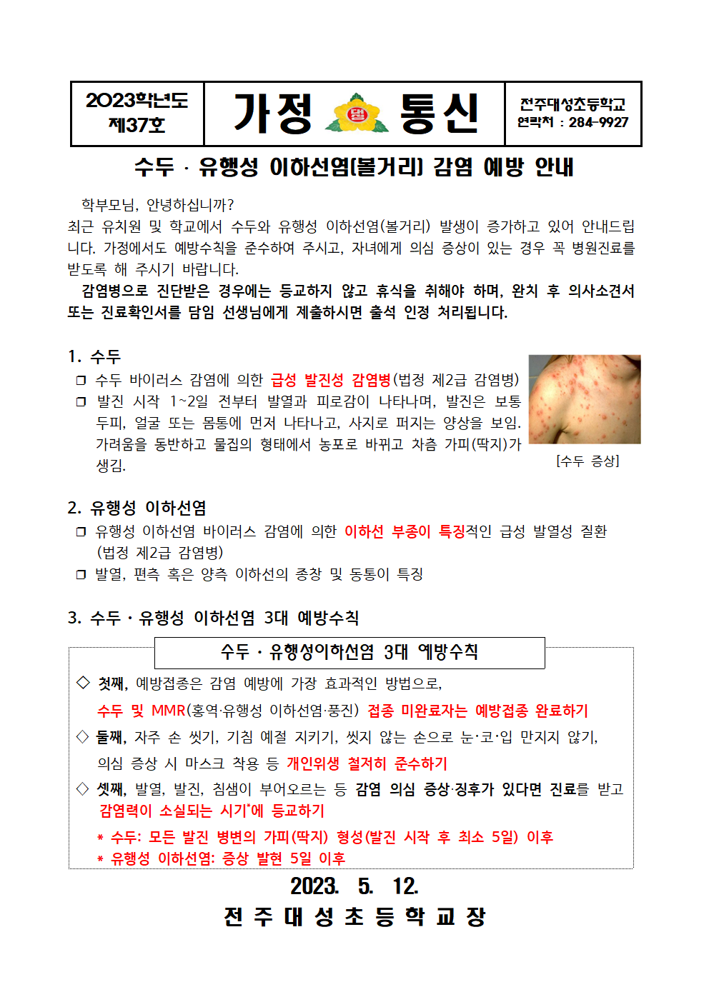 제37호-수두 및 유행성 이하선염 감염 예방 안내문001
