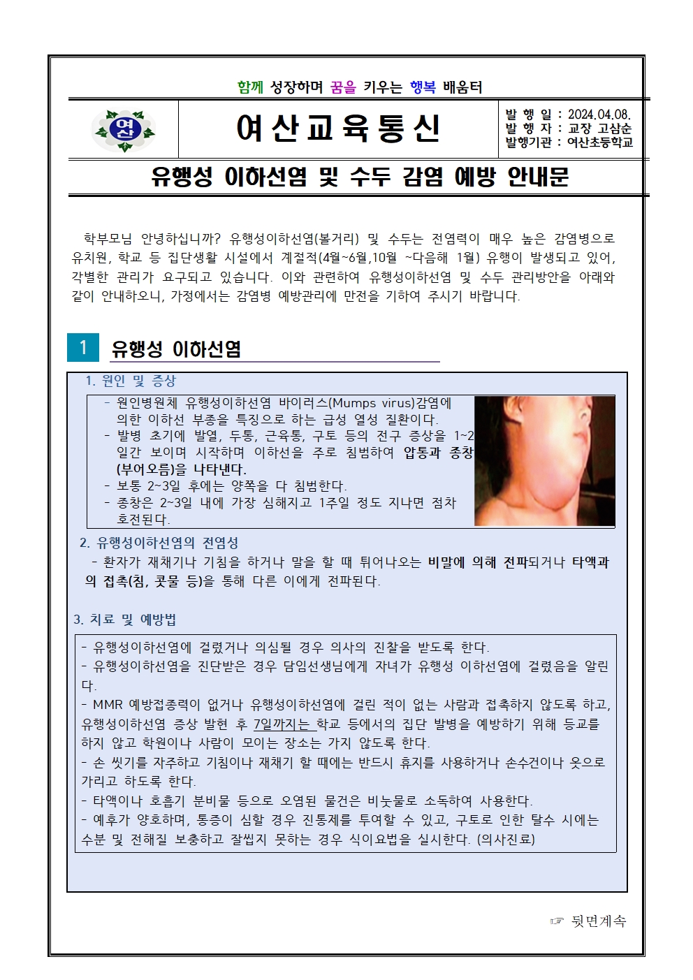 유행성이하선염 및 수두 감염 예방 안내문001