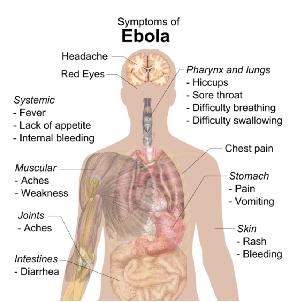 에볼라.png